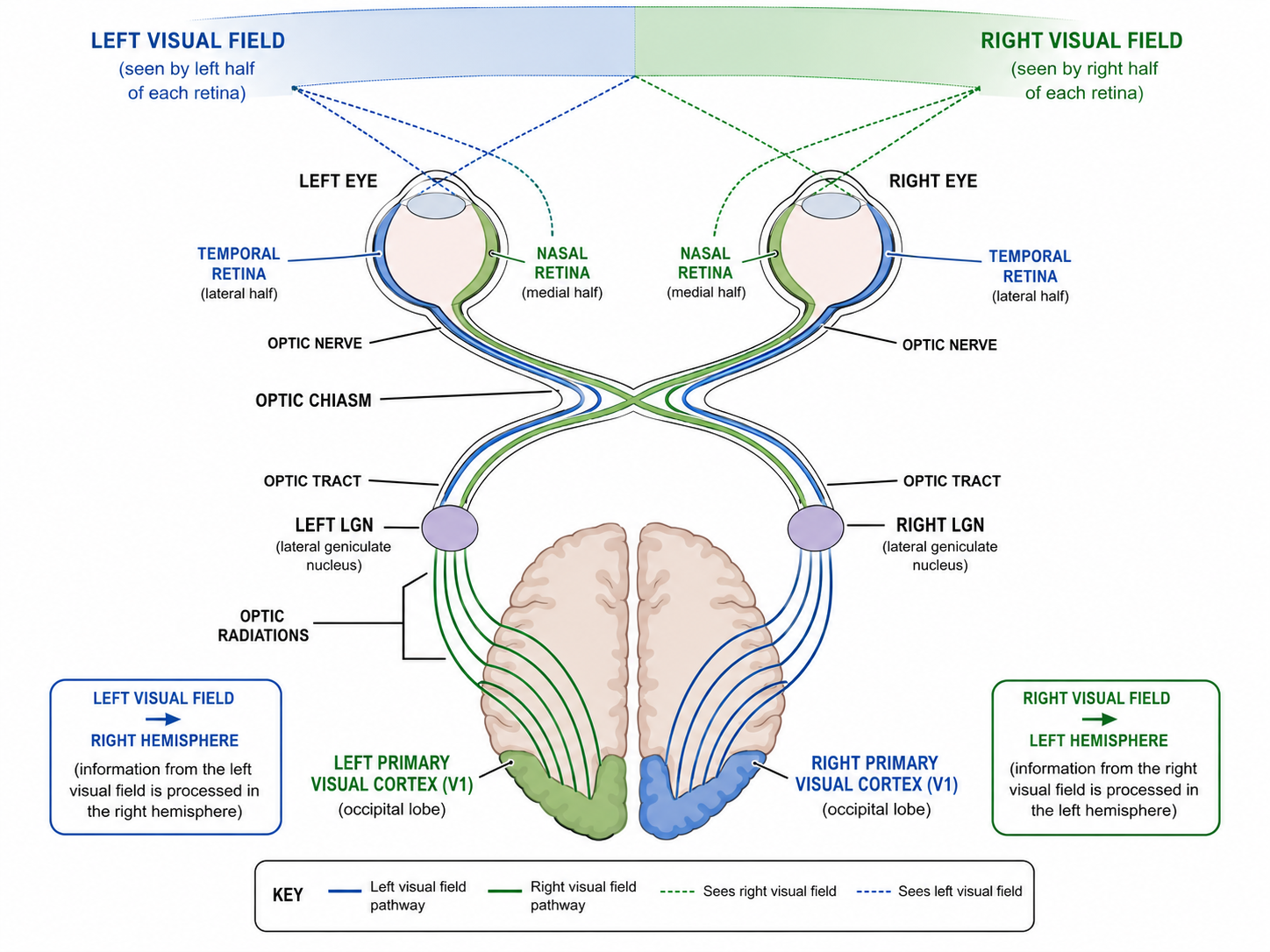 Visual pathway from each visual field through the optic chiasm to the contralateral occipital cortex, showing where nasal fibers cross